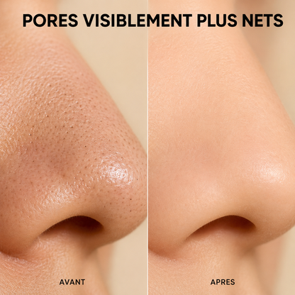 Comparatif avant/après - pores visiblement plus nets